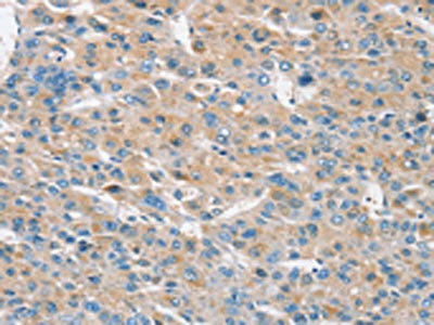 RASA3 Antibody (PACO20322)