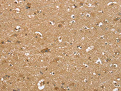 RNF148 Antibody (PACO20354)