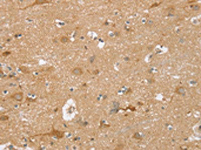 TRIM34 Antibody (PACO20356)