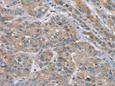 SAMD9 Antibody (PACO20388)