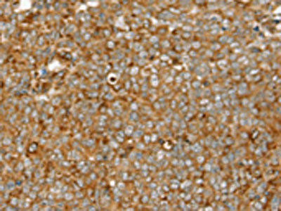 SIGLEC11 Antibody (PACO20462)
