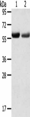 SLC16A9 Antibody (PACO20476)