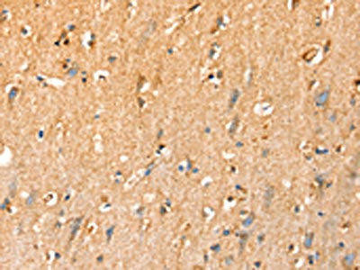 SLC25A3 Antibody (PACO20493)