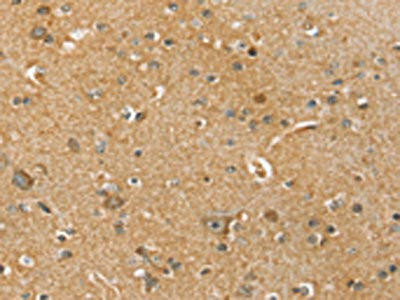 SLC41A2 Antibody (PACO20510)