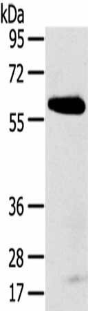 SPATA18 Antibody (PACO20590)