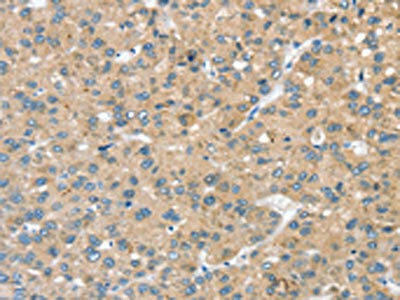 STK32C Antibody (PACO20620)