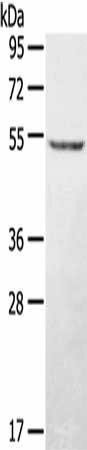 STYK1 Antibody (PACO20623)
