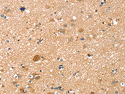 TMSB10 Antibody (PACO20643)