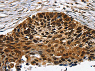 TACC2 Antibody (PACO20648)