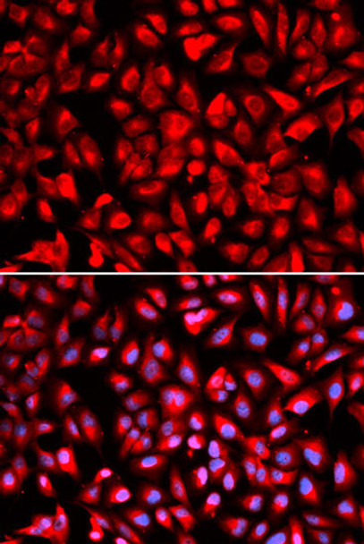 Anti-IPO5 Antibody (CAB1984)