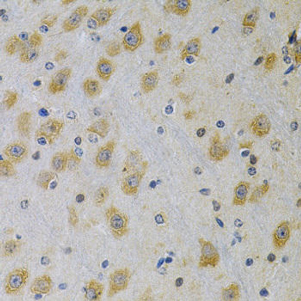 Anti-IGFBP4 Antibody (CAB2008)