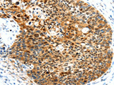 HUNK Antibody (PACO20743)