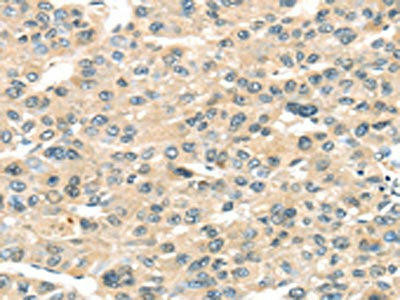 HAUS7 Antibody (PACO20813)
