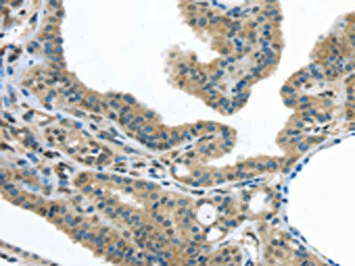 VLDLR Antibody (PACO20857)