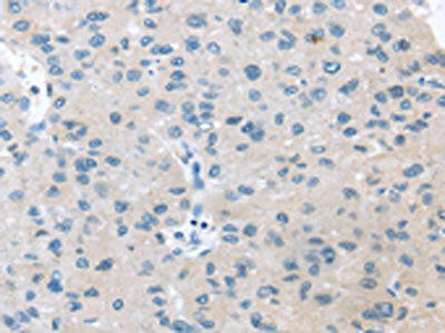 VPS4B Antibody (PACO20863)