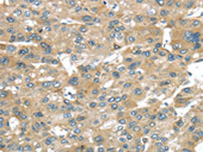 BRWD1 Antibody (PACO20873)