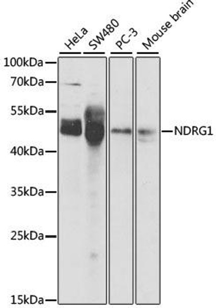 Anti-NDRG1 Antibody (CAB2142)