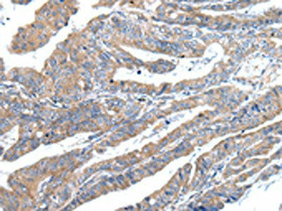 ZFAND2A Antibody (PACO20944)