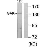 GAK Antibody (PACO21683)