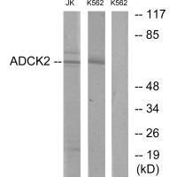 ADCK2 Antibody (PACO21885)