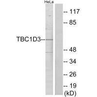 TBC1D3 Antibody (PACO21893)