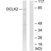 DCLK2 Antibody (PACO21896)