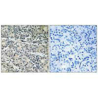 MP68 Antibody (PACO22096)