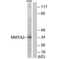 MMTAG2 Antibody (PACO22152)
