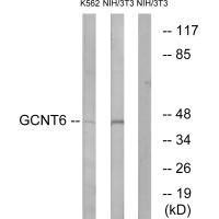 GCNT6 Antibody (PACO22193)