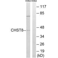 CHST8 Antibody (PACO22229)