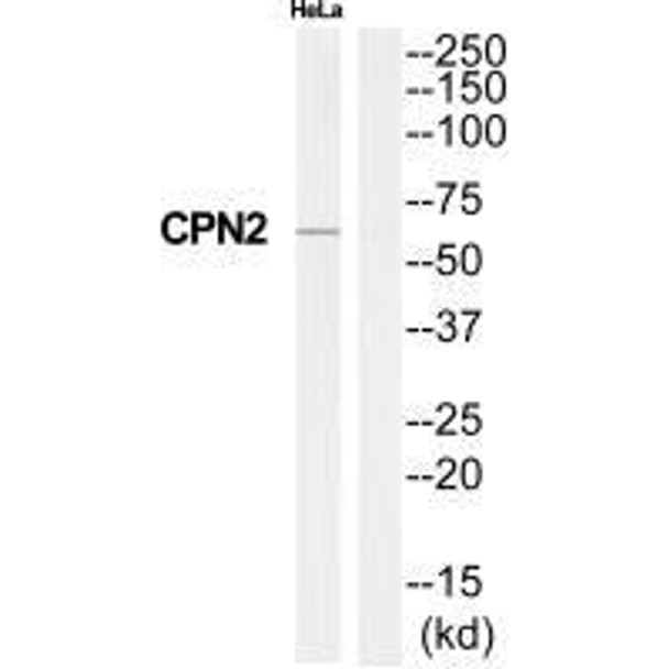CPN2 Antibody (PACO22241)