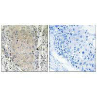 CBLN3 Antibody (PACO22258)