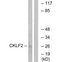 CMTM2 Antibody (PACO22272)