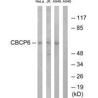 AGBL4 Antibody (PACO22298)