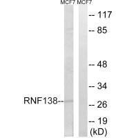 RNF138 Antibody (PACO22321)