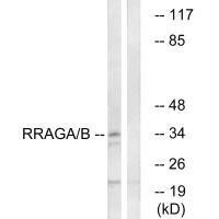 RRAGA/RRAGB Antibody (PACO22551)