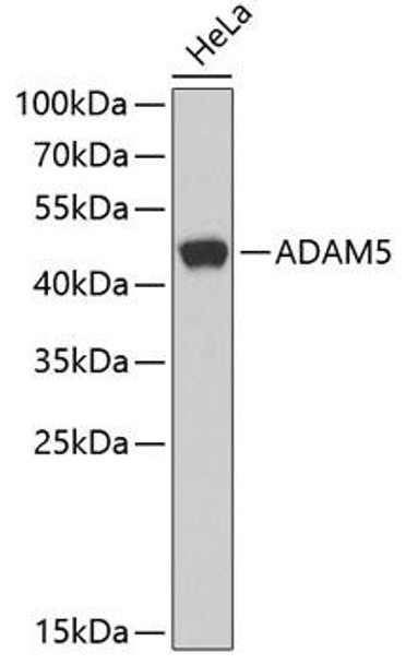 Anti-ADAM5 Antibody (CAB6196)