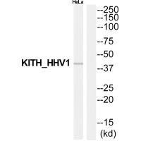 TK Antibody (PACO22733)
