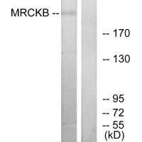 CDC42BPB Antibody (PACO23300)