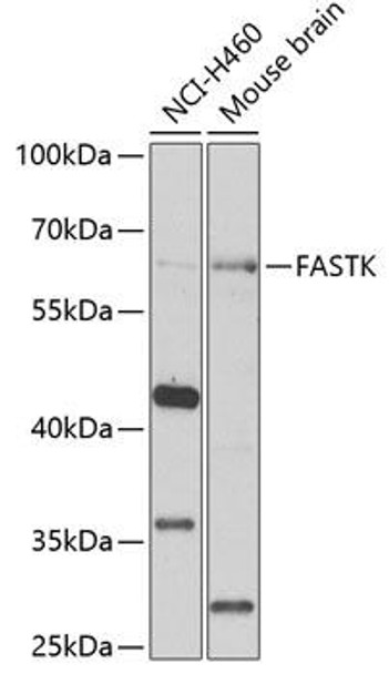 Anti-FASTK Antibody (CAB7069)