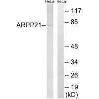 ARPP21 Antibody (PACO23400)