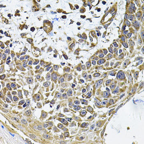 Anti-ICOSL Antibody (CAB7080)