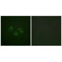 EPHA2/EPHA3/EPHA4 (Ab-588/596) Antibody (PACO23718)