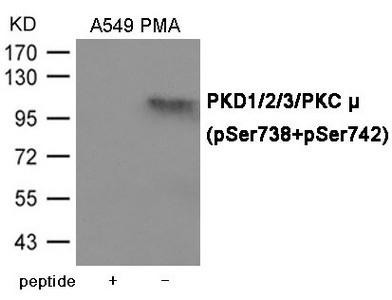 Phospho-PRKD1/PRKD2/PRKD3 (Ser738/742) Antibody (PACO23993)