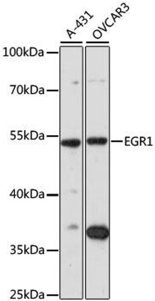 Anti-EGR1 Antibody (CAB7266)