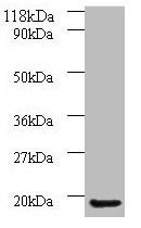 AP1S3 Antibody (PACO24952)