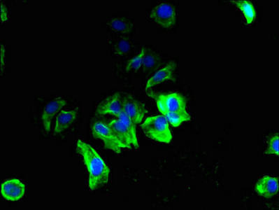 SMCO3 Antibody (PACO25312)