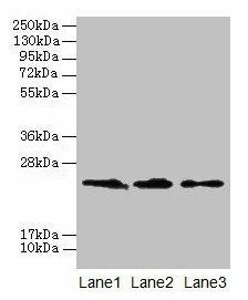 CLDN20 Antibody (PACO25789)