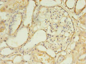 DLEU1 Antibody (PACO26245)