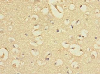 EVI2A Antibody (PACO26577)